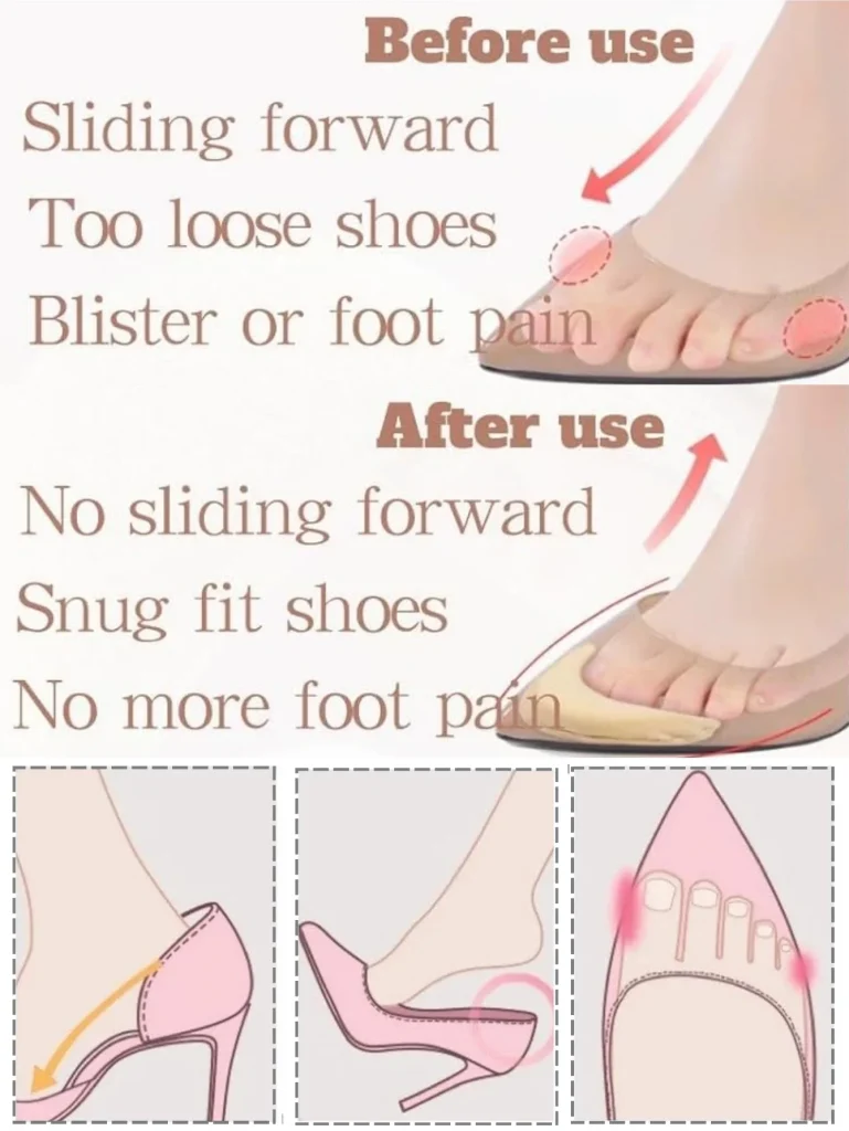 Inserts d'avant-pied en mousse : détail